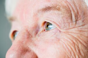 Glaucoma