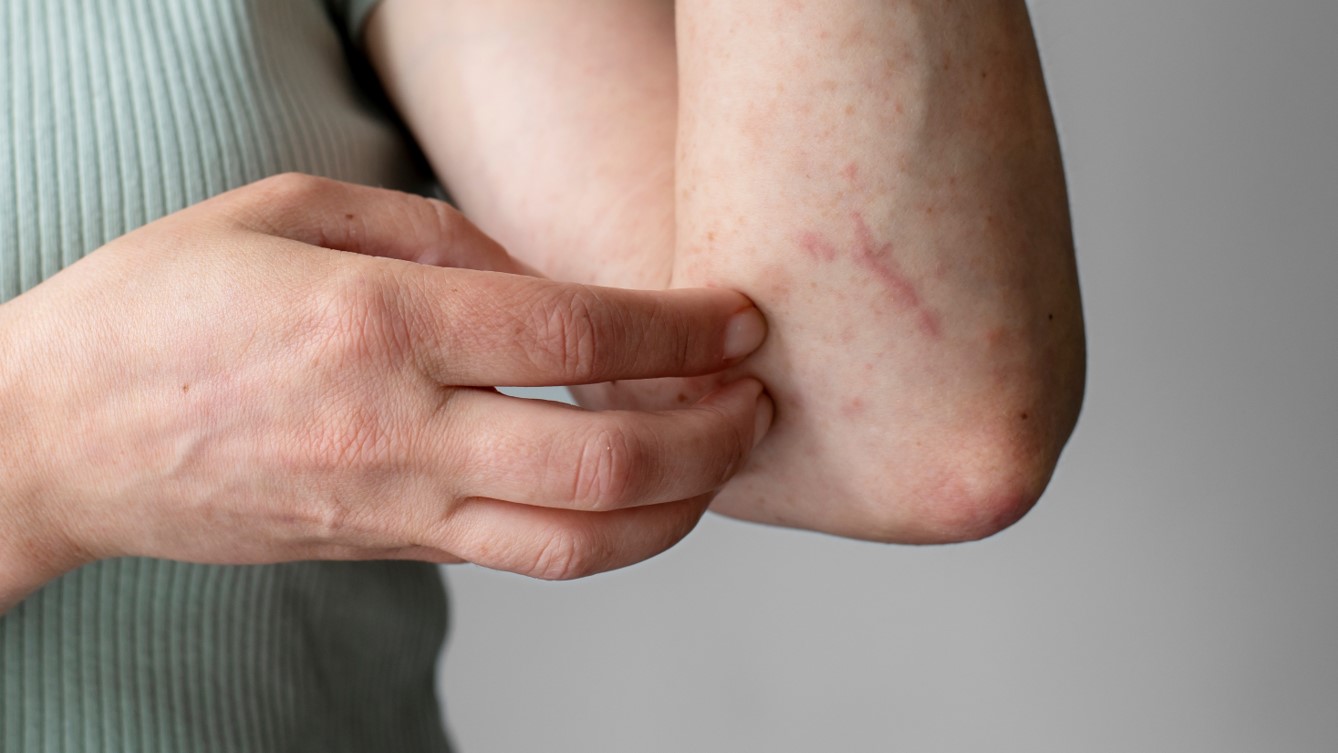Dermatite atópica: a doença comum que afeta todas as idades - Trofa Saúde  Barcelos