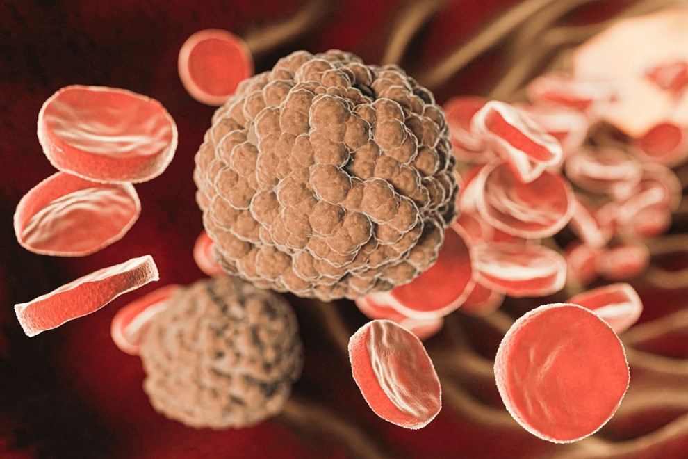 Dislipidemia