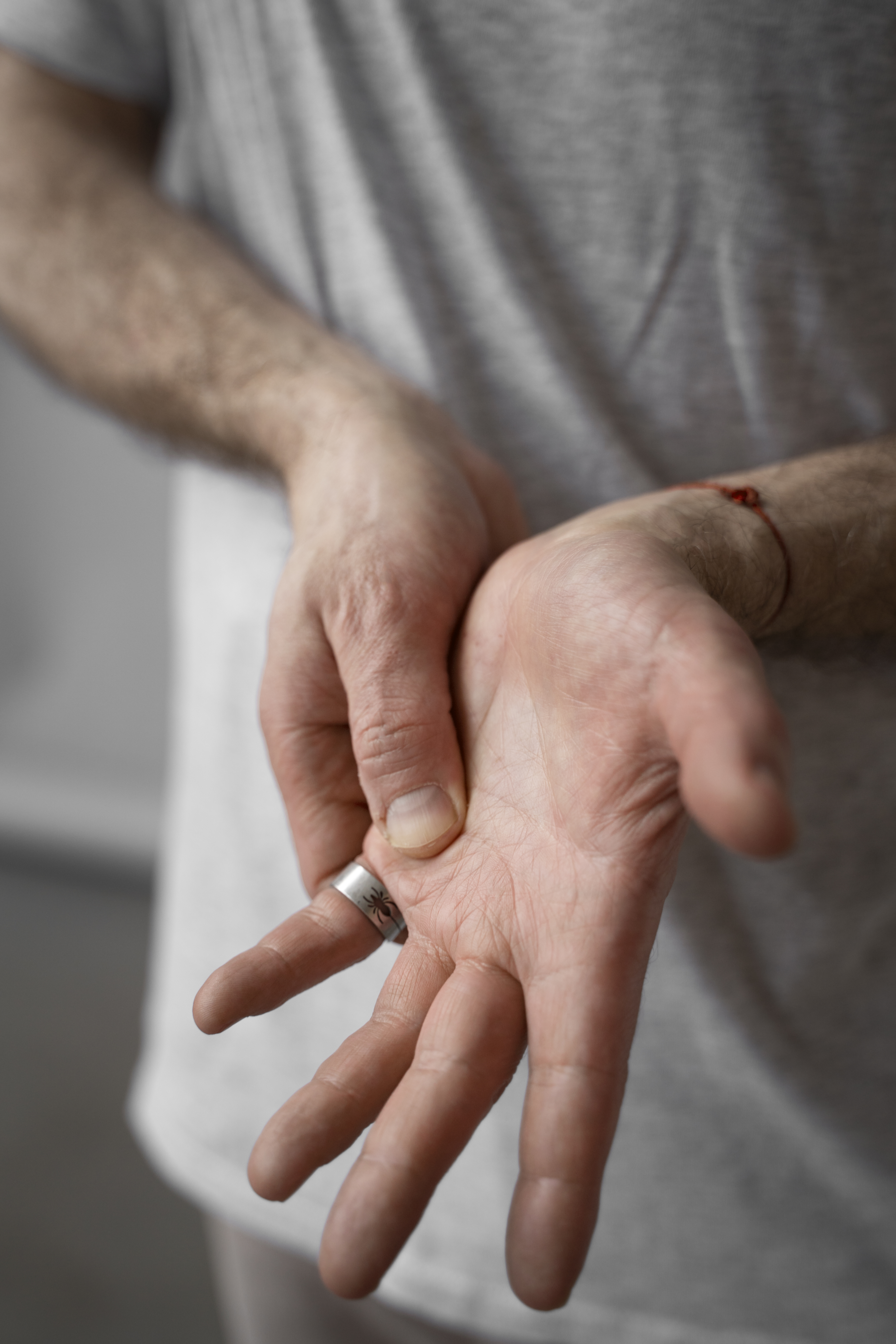 Síndrome de Raynaud