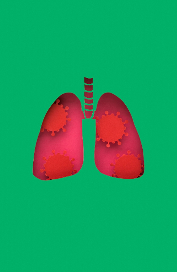Tuberculose
