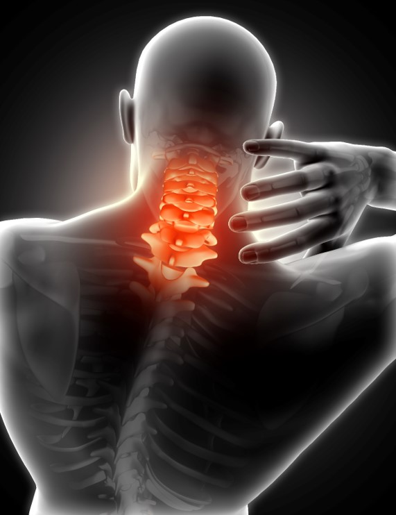 Estenose do Canal Cervical