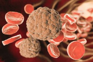 Dislipidemia