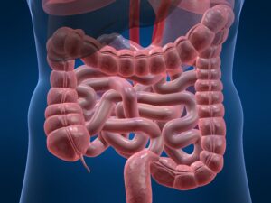 Doença Inflamatória Intestinal