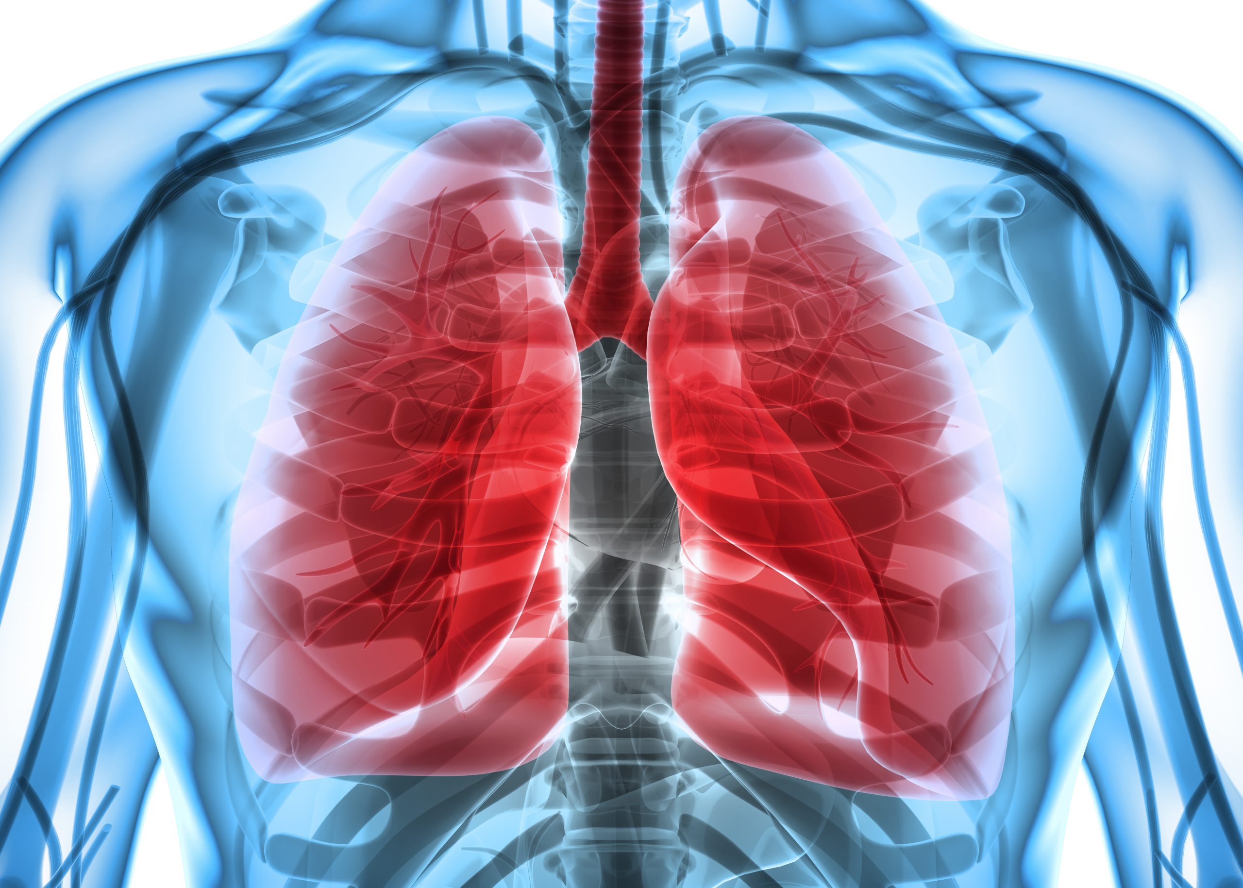 Cancro do pulmão