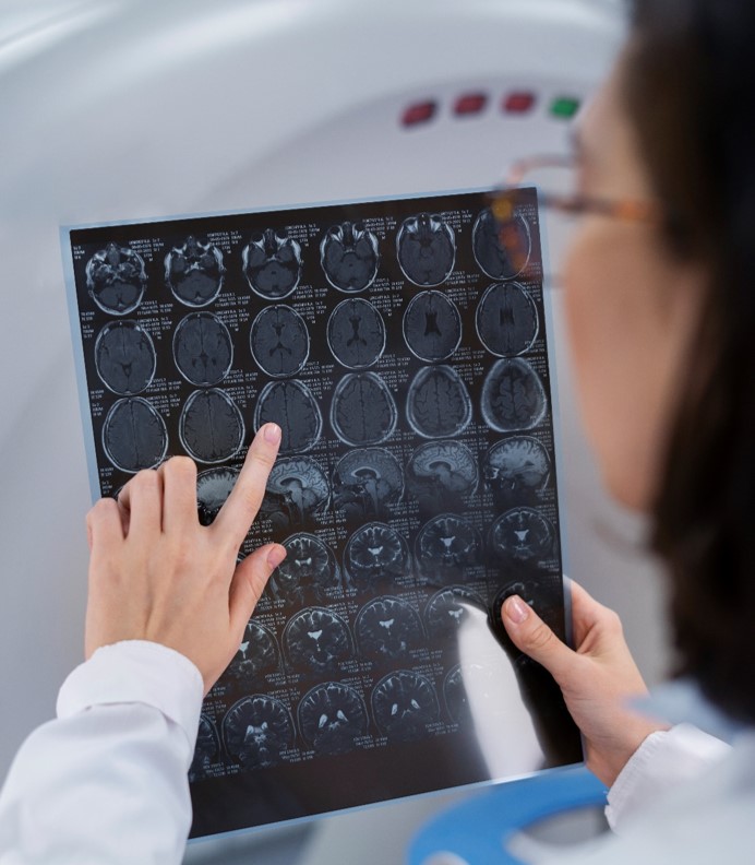 neurorradiologia