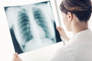 Pneumonia