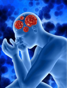 Doenças Cerebrovasculares Crónicas