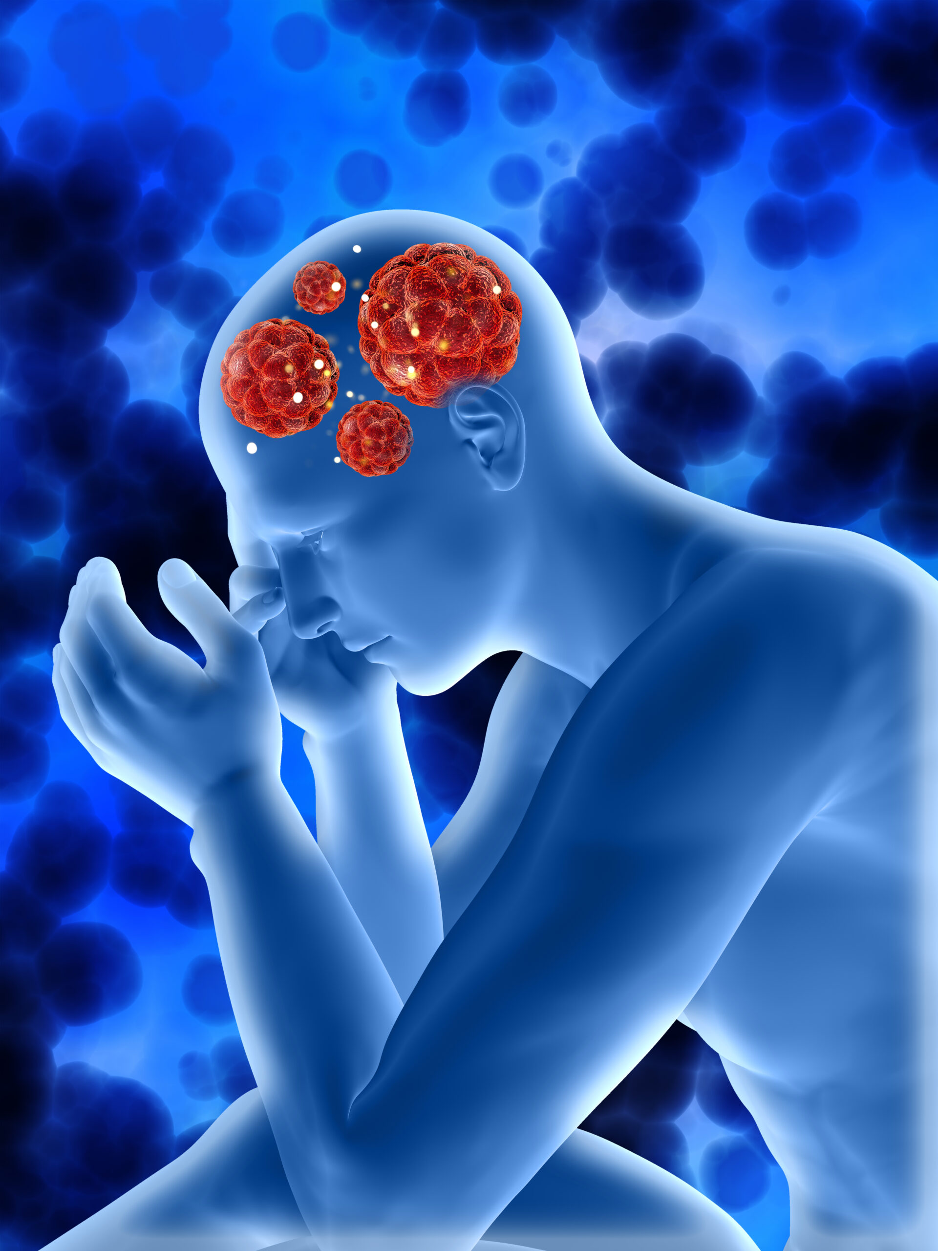 Neurofibromatose